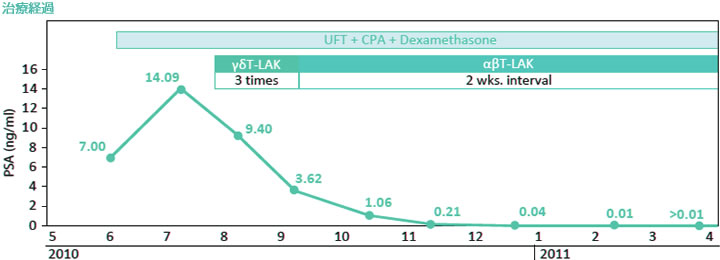 日本免疫細胞治療(瀨田診所)：前列腺癌，男，68歲