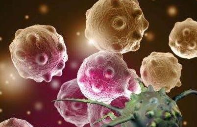 日本專家談腫瘤?惡性淋巴瘤篇