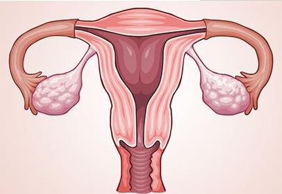 日本專家談腫瘤?子宮癌