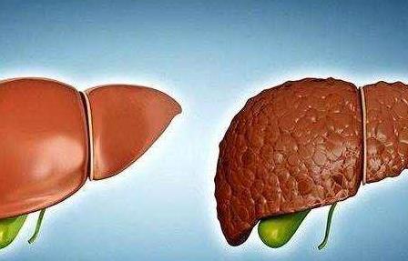 肝功能指標的基本意義