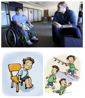 日本藤田醫(yī)科大學教授談罕見病DMD 新藥獲批！有望造福DMD患者！