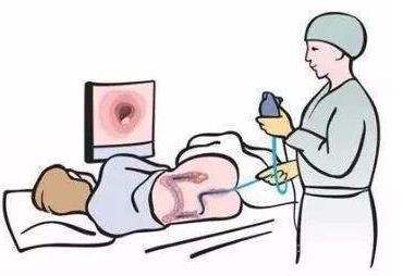 日本專家實例呼吁：不要忽視腸鏡檢查前的影像檢查